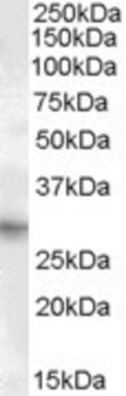 PRRX1 Antibody, Novus Biologicals 0.1mg; Unlabeled:Antibodies, Polyclonal