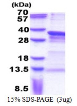Novus Biologicals&trade;&nbsp;Recombinant Human PRRX1 His Protein