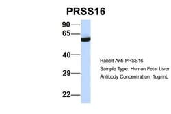 PRSS16 Antibody, Novus Biologicals 100&mu;L; Unlabeled:Antibodies, Polyclonal