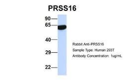 PRSS16 Antibody, Novus Biologicals 100&mu;L; Unlabeled:Antibodies, Polyclonal