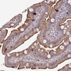 PRSS33 Antibody, Novus Biologicals 0.1mL; Unlabeled:Antibodies, Polyclonal