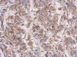 PRSS35 Antibody, Novus Biologicals 0.1mL; Unlabeled:Antibodies, Polyclonal