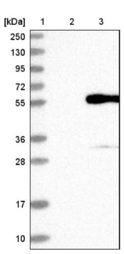 PRSS35 Antibody, Novus Biologicals 0.1mL; Unlabeled:Antibodies, Polyclonal