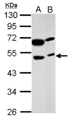 PRSS35 Antibody, Novus Biologicals 0.1mL; Unlabeled:Antibodies, Polyclonal