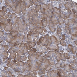 PRSS35 Antibody, Novus Biologicals 25 &mu;L, Unlabeled:Antibodies, Polyclonal