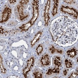 PRSS35 Antibody, Novus Biologicals 0.1mL; Unlabeled:Antibodies, Polyclonal