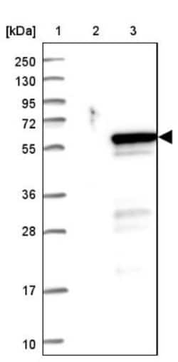 PRSS35 Antibody, Novus Biologicals 25 &mu;L, Unlabeled:Antibodies, Polyclonal