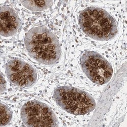 PRSS36 Antibody, Novus Biologicals 25 &mu;L, Unlabeled:Antibodies, Polyclonal