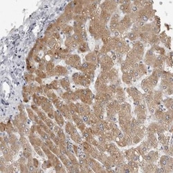 PRSS38 Antibody, Novus Biologicals 25 &mu;L, Unlabeled:Antibodies, Polyclonal