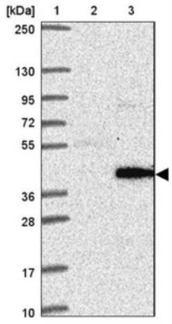 PRSS38 Antibody, Novus Biologicals 25 &mu;L, Unlabeled:Antibodies, Polyclonal