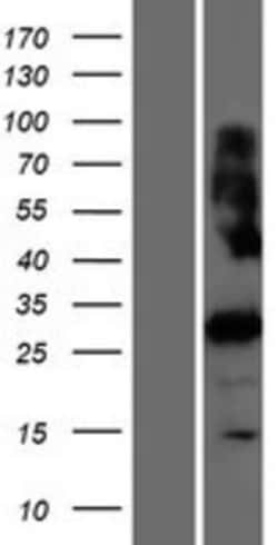 Novus Biologicals™ PRSS42 Overexpression Lysate