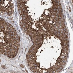 PRSS53 Antibody, Novus Biologicals:Antibodies:Primary Antibodies