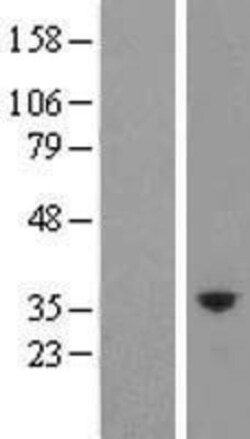 Novus Biologicals™ Kallikrein 10 Overexpression Lysate
