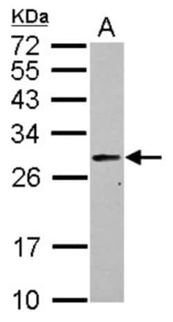 PRTFDC1 Antibody, Novus Biologicals 0.1mL; Unlabeled:Antibodies, Polyclonal