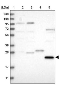 PRTFDC1 Antibody, Novus Biologicals 25 &mu;L; Unlabeled:Antibodies, Polyclonal