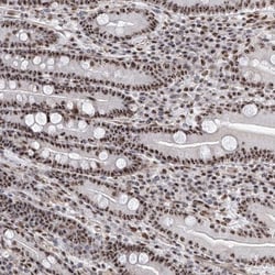 PRUNE2 Antibody, Novus Biologicals 0.1mL; Unlabeled:Antibodies, Polyclonal