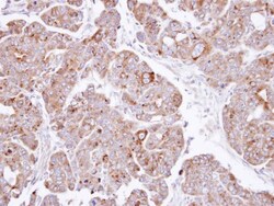 PSAP Antibody, Novus Biologicals 0.1mL; Unlabeled:Antibodies, Polyclonal
