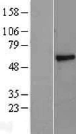 Novus Biologicals&trade;&nbsp;PSAP Overexpression Lysate