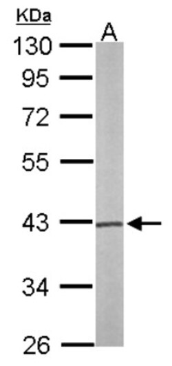 PSAT1 Antibody, Novus Biologicals 0.1 mL | Buy Online | Novus Biologicals | Fisher Scientific