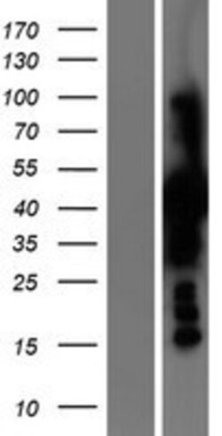Novus Biologicals PSAT1 Overexpression Lysate 0.1 mg | Buy Online | Novus Biologicals&trade; | Fisher Scientific