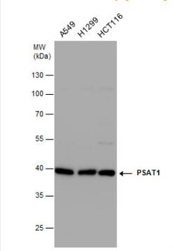 PSAT1 Antibody, Novus Biologicals 0.1 mL | Buy Online | Novus Biologicals | Fisher Scientific