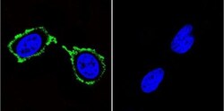 PSD-95 Antibody (6G6-1C9) - BSA Free, Novus Biologicals 0.1mL; Unlabeled:Antibodies,