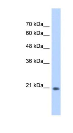 PSF2 Antibody, Novus Biologicals 100&mu;L; Unlabeled:Antibodies, Polyclonal