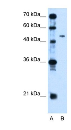 PSG1 Antibody, Novus Biologicals 100&mu;L; Unlabeled:Antibodies, Polyclonal
