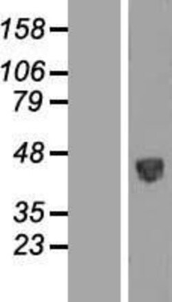 Novus Biologicals&trade;&nbsp;PSG5 Overexpression Lysate