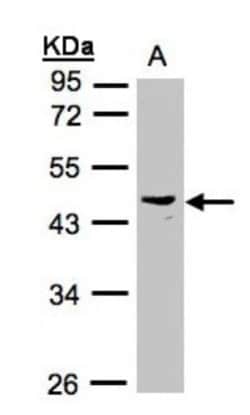 PSG6 Antibody, Novus Biologicals 0.1mg; Unlabeled:Antibodies, Polyclonal