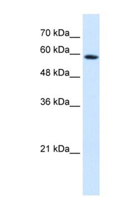PSG9 Antibody, Novus Biologicals 0.05mg; Unlabeled:Antibodies, Polyclonal