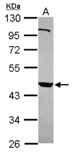 PSG9 Antibody, Novus Biologicals 0.1mL; Unlabeled:Antibodies, Polyclonal