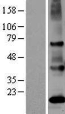 Novus Biologicals™ PSGR Overexpression Lysate