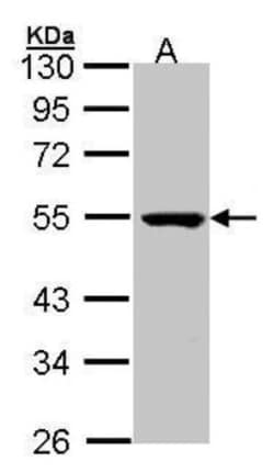 PSKH1 Antibody, Novus Biologicals 0.1mL; Unlabeled:Antibodies, Polyclonal