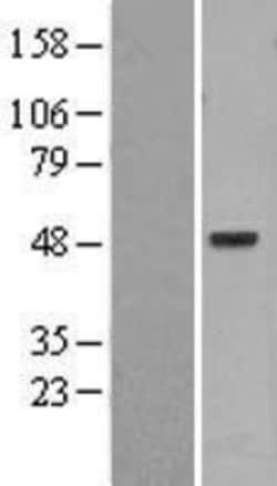 Novus Biologicals&trade;&nbsp;PSKH1 Overexpression Lysate