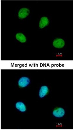 PSKH2 Antibody, Novus Biologicals 0.1mg; Unlabeled:Antibodies, Polyclonal