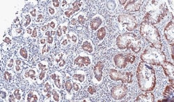 PSKH2 Antibody, Novus Biologicals 0.1mg; Unlabeled:Antibodies, Polyclonal