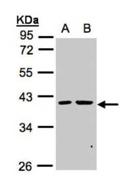 PSKH2 Antibody, Novus Biologicals 0.1mg; Unlabeled:Antibodies, Polyclonal