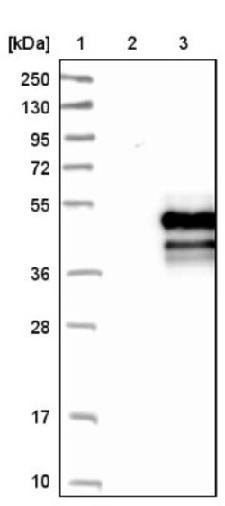 Coronin-2B Antibody, Novus Biologicals:Antibodies:Primary Antibodies