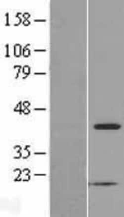 Novus Biologicals&trade;&nbsp;PSKH2 Overexpression Lysate