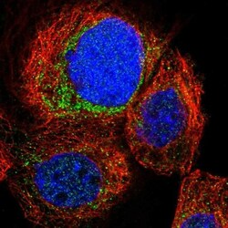 Coronin-2B Antibody, Novus Biologicals:Antibodies:Primary Antibodies