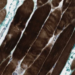 Coronin-2B Antibody, Novus Biologicals:Antibodies:Primary Antibodies