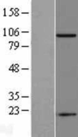 Novus Biologicals™ PSMA/FOLH1/NAALADase I Overexpression Lysate
