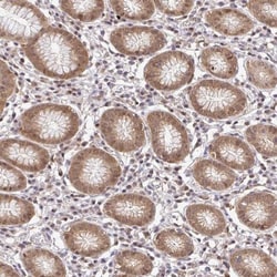 PSMA4 Antibody, Novus Biologicals:Antibodies:Primary Antibodies