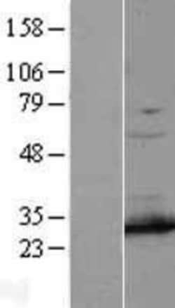 Novus Biologicals&trade;&nbsp;PSMA7 Overexpression Lysate
