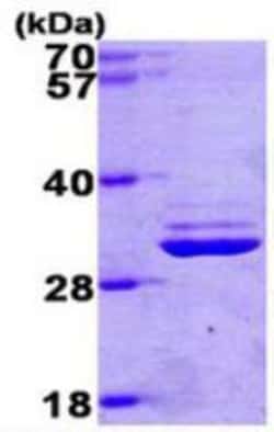 Novus Biologicals&trade;&nbsp;Recombinant Human PSMA7 His Protein