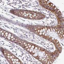 PSMB11 Antibody, Novus Biologicals 0.1mL; Unlabeled:Antibodies, Polyclonal