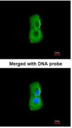 PSMC3 Antibody, Novus Biologicals 0.1mg; Unlabeled:Antibodies, Polyclonal