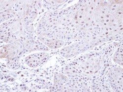PSMC3 Antibody, Novus Biologicals 0.1mg; Unlabeled:Antibodies, Polyclonal