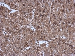 PSMC3 Antibody, Novus Biologicals 0.1mL; Unlabeled:Antibodies, Polyclonal